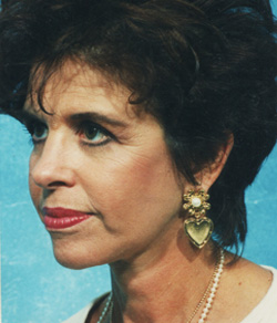 Facelift After - Ft. Myers FL Facelift After - Ft. Myers FL