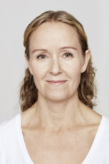 Dysport® Before - Ft. Myers FL