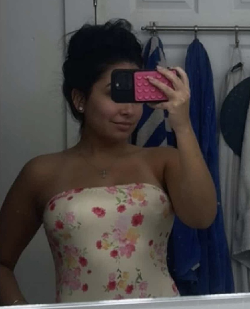 Sharma Plastic Surgery Selfie Gallery Sharma Plastic Surgery Selfie Gallery